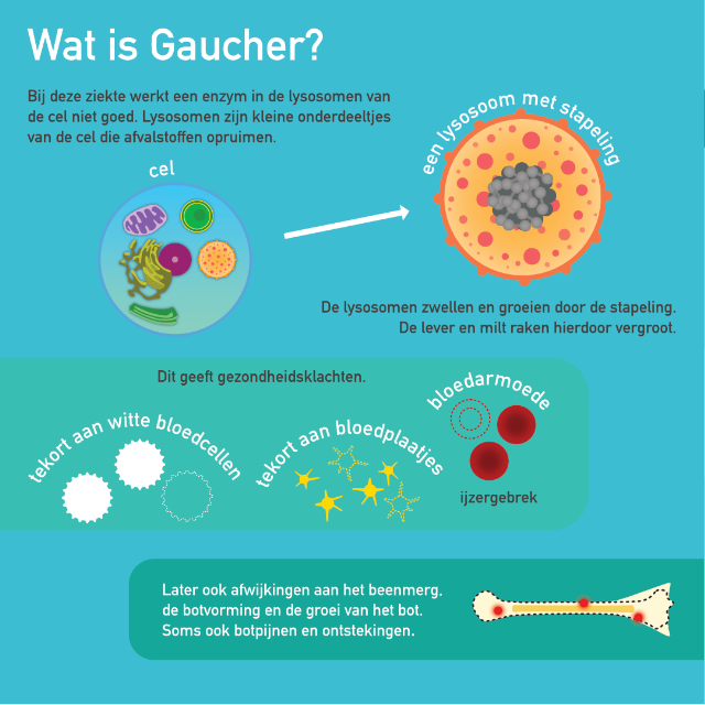 Ziekte van Gaucher type 1 infographic afbeelding 0